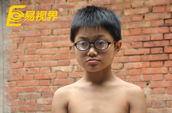11歲男孩近視2200度 易視界呼吁關愛孩子視力