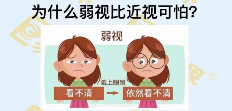 為什么弱視比近視可怕？