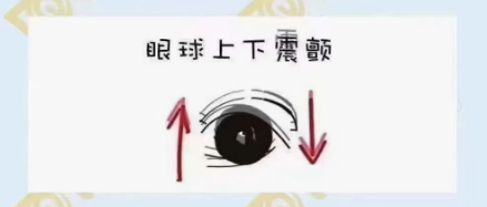 什么是眼球震顫？