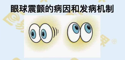 眼球震顫的病因和發病機制
