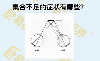 集合不足的癥狀有哪些？